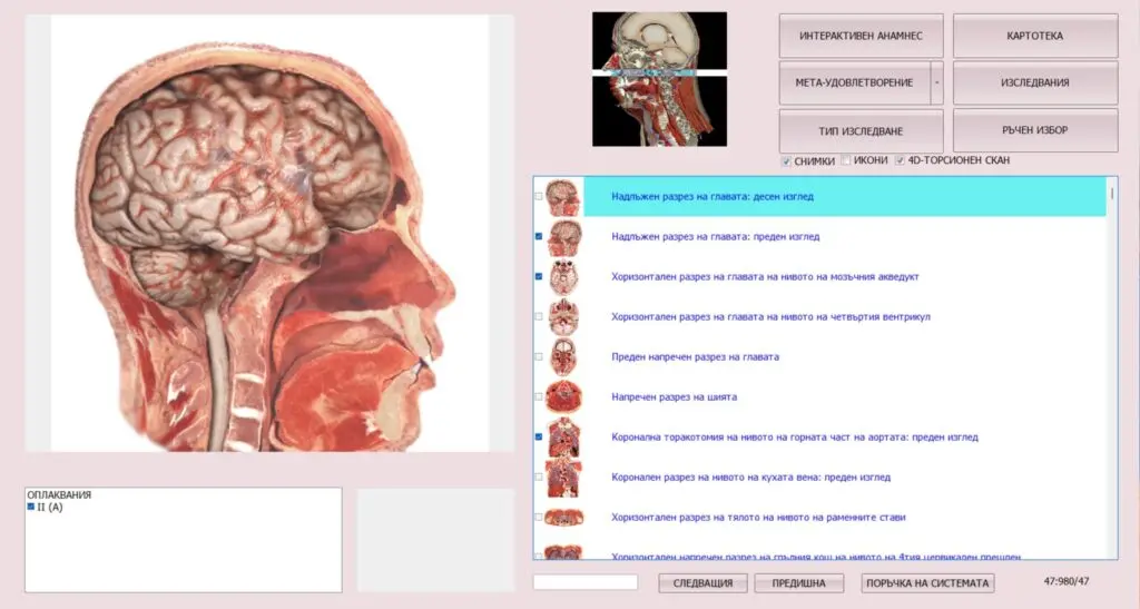 Биорезонансно изследване